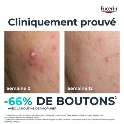EUCERIN - Dermopure serum triple action 40 ml | DERMO